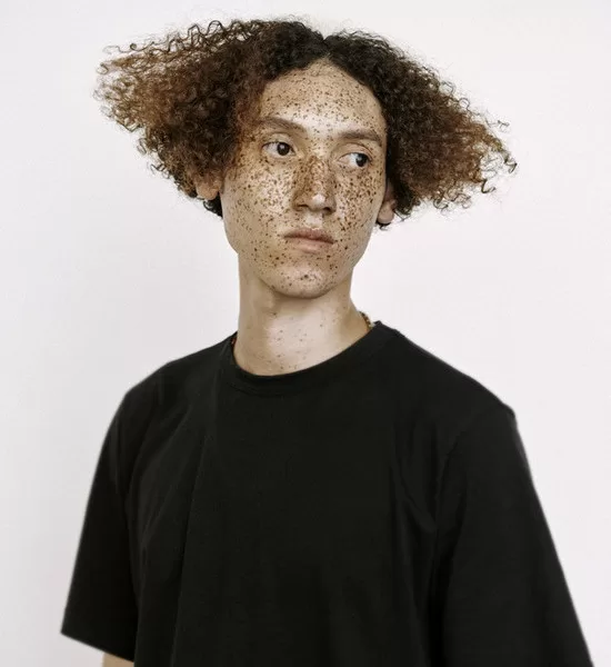 Jan Balcařík je tvůrcem uprav tohoto účesu. Vlasy jako ve tvaru trojúhelníků se základnou na stranách jeho hlavy, zrzavé a kudrnaté.